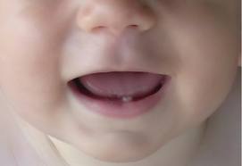first tooth